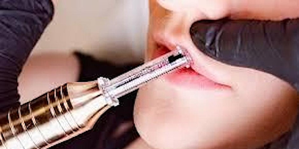 Newark, Nj : Hyaluron Pen Training, Learn to Fill in Lips & Dissolve Fat!